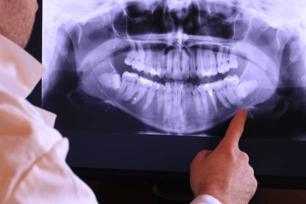 Best Emergency Dental Services for Seniors in Churchill, PA